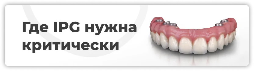 Где IPG нужна критически