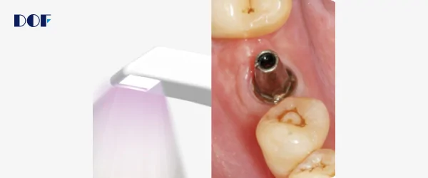 dof интраоральный сканер freedom i-4.png