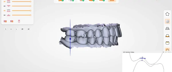 Интраоральный сканер UP3D Clariscan UP610.png