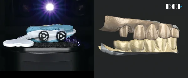 DOF Freedom UHD сканер-2.png