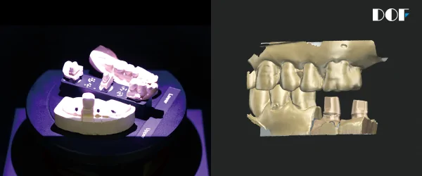 DOF Freedom UHD сканер-3.png