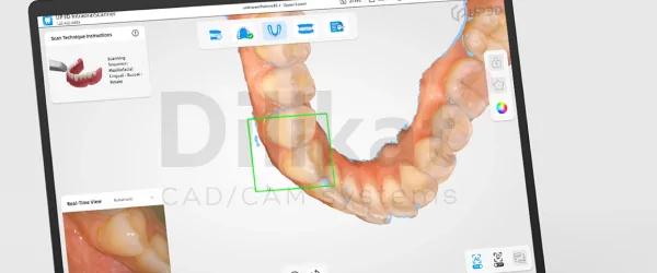 Интраоральный сканер UP3D Clariscan UP610 (4).png