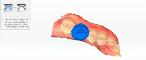 Aoralscan Lync (11).png