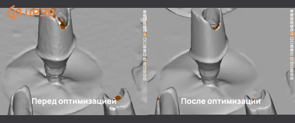 3D сканер Up3D Up560 HD - Сравнение эффекта сканирования абатмента.png