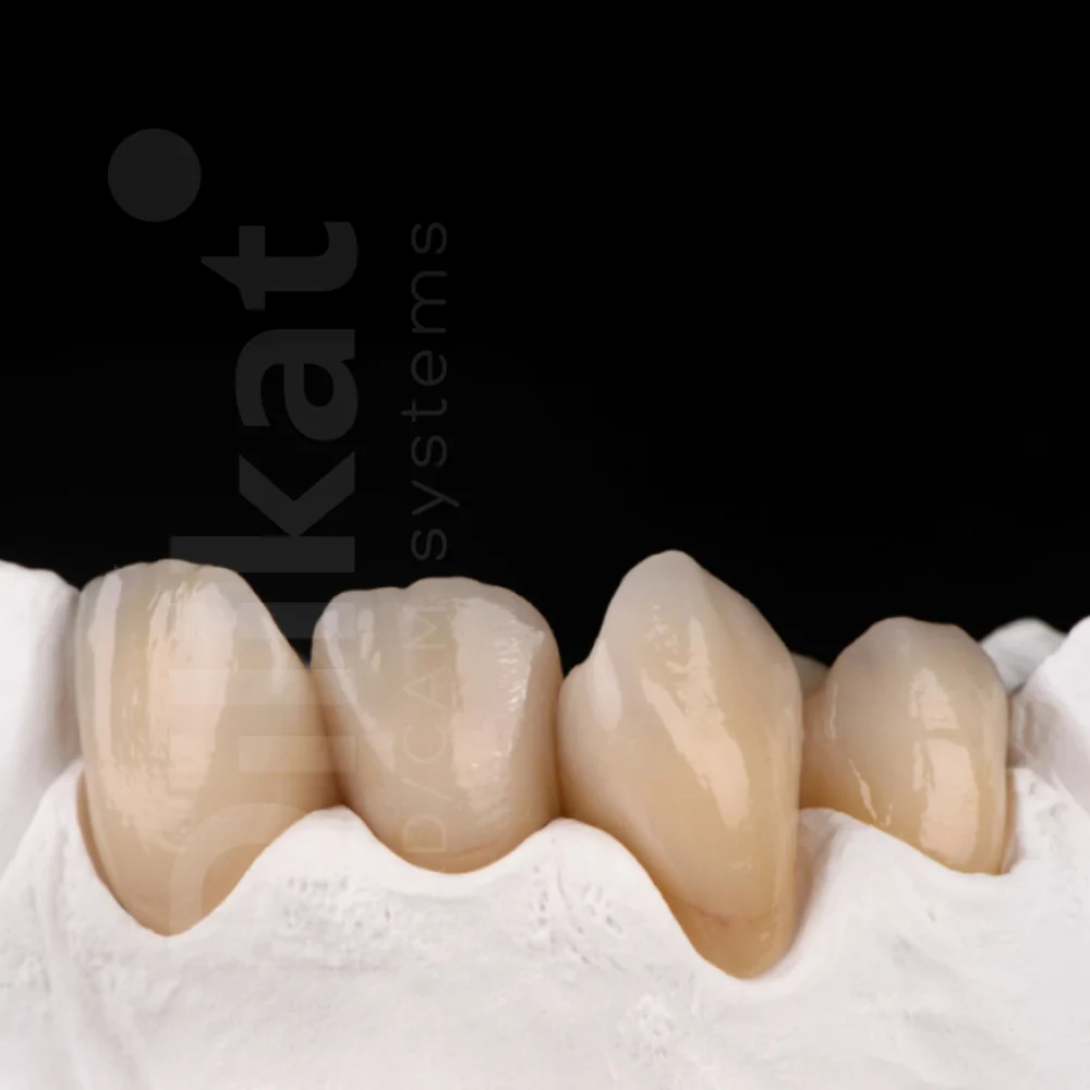 dilikat-cad-cam-block-pritidenta-zirconia-multi-translucent-5.jpg