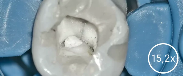 SREFO R-1513 (16).png