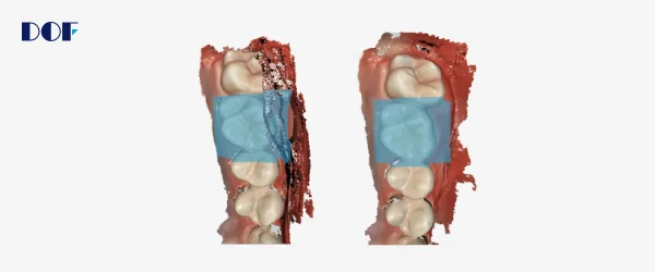 dof интраоральный сканер freedom i.png