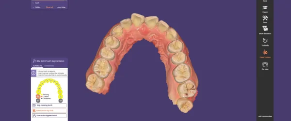 Aoralscan Lync (16).png