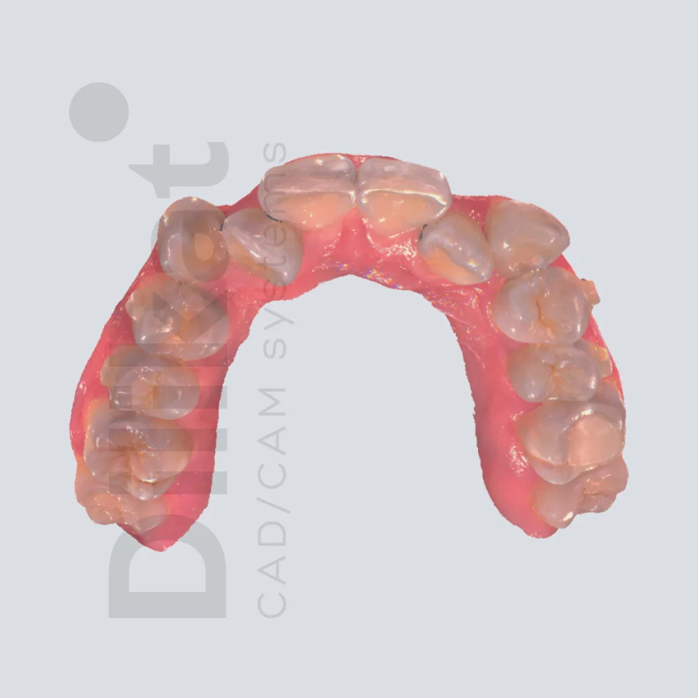 dilikat-3d-intraoralny-skaner-shining3d-aoralscan-l-15.jpg