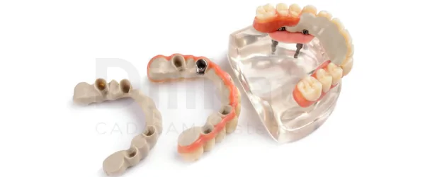 dilikat peek (1).png