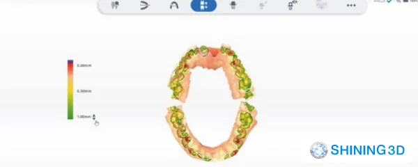 Анализ Прикуса.png Анализ Прикуса.png