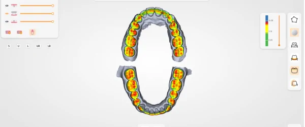 Интраоральный сканер UP3D Clariscan UP610-2.png