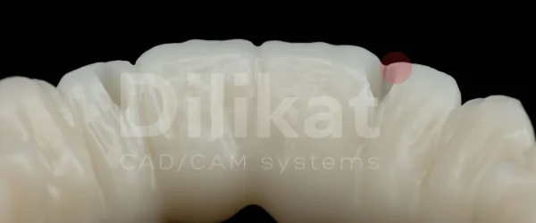 dilikat pmma mono (1).png
