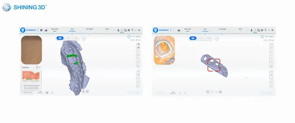 aoralscan 3 light (8).png