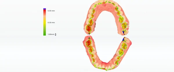 Aoralscan Lync (15).png
