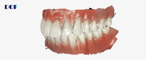 dof интраоральный сканер freedom i-1.png