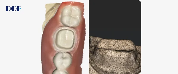dof интраоральный сканер freedom i-3.png