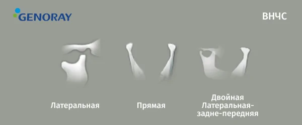 Papaya 3d (1).png