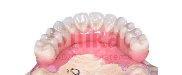 Zirdent 3D ultra.png