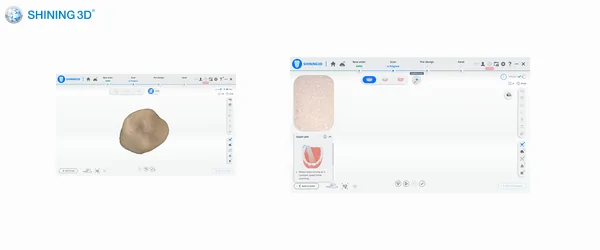 aoralscan 3 light (5).png