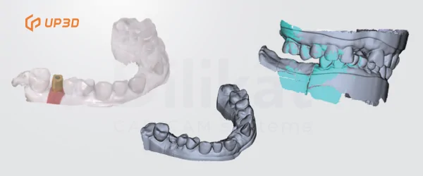 Интраоральный сканер UP600.png