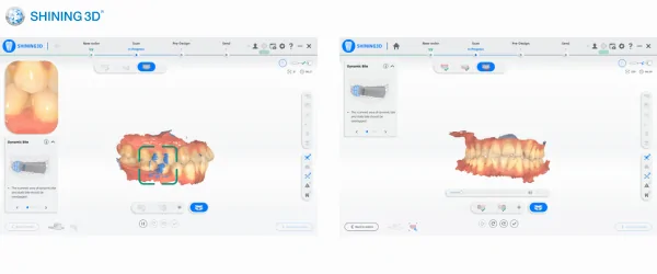 aoralscan 3 light (7).png