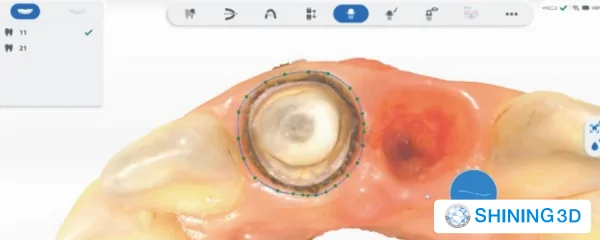 Усовершенствованное Сканирование.png Усовершенствованное Сканирование.png