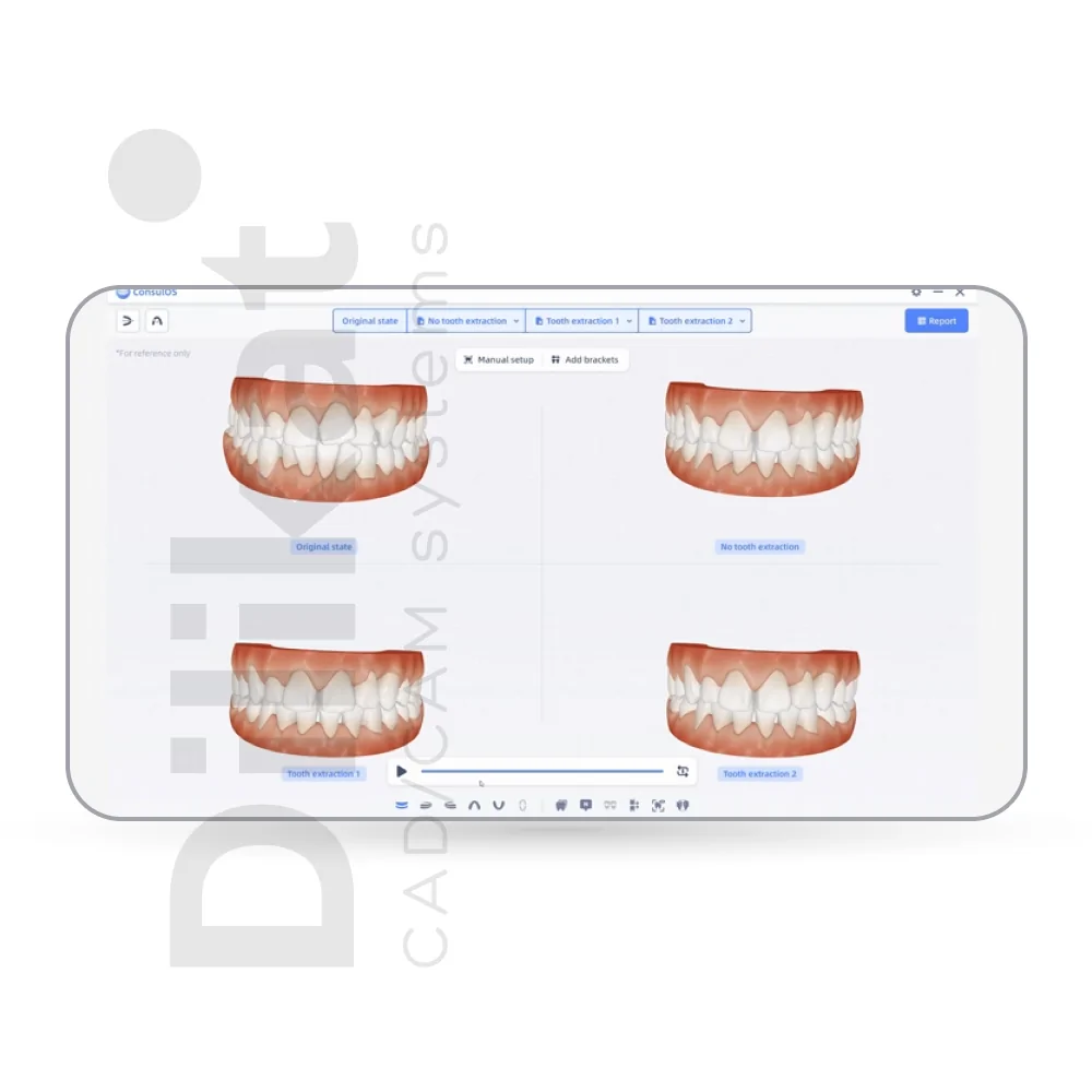 dilikat-3d-intraoralny-skaner-shining3d-aoralscan-l-20.jpg