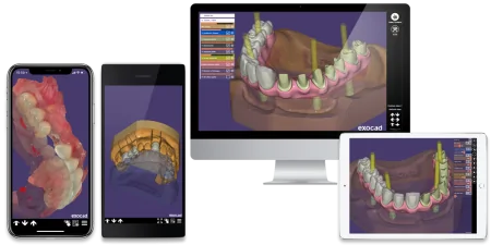 Программное обеспечение EXOCAD Dental CAD
