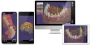 Программное обеспечение EXOCAD Dental CAD
