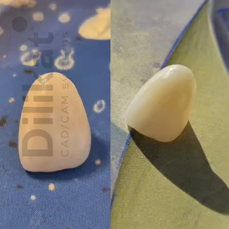 Печь для синтеризации циркона DOF Zirfire SF