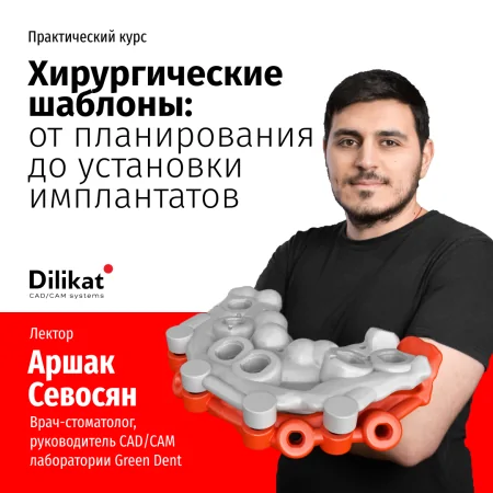 Хирургические шаблоны: от планирования до установки имплантатов