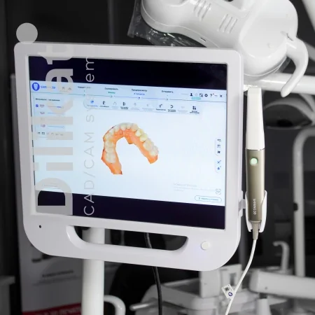 Интраоральный сканер Shining 3D Aoralscan Elite