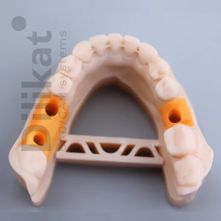 Фотополимер Gorky Liquid Dental Gingiva LCD/DLP